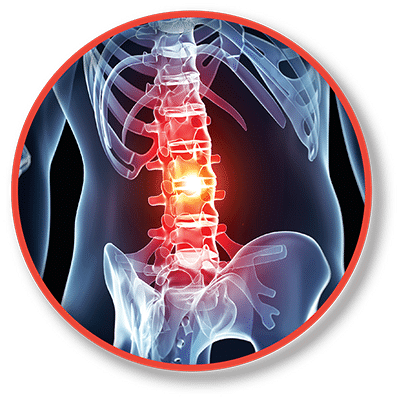 Orthopedic orthopedic button